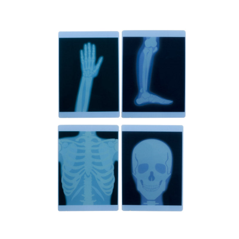 Radiografias Raio X (4 peças)