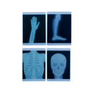 Radiografias Raio X (4 peças)