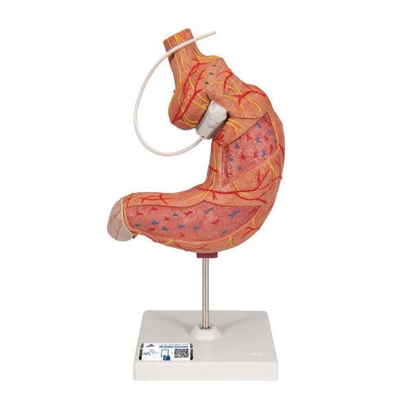 Modelo anatómico do estômago com banda gástrica