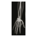 Set of human bone radiographs (18 pieces)