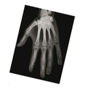 Set of human bone radiographs (18 pieces)