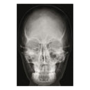 Set of human bone radiographs (18 pieces)