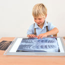 Set of human bone radiographs (18 pieces)