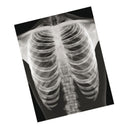 Set of human bone radiographs (18 pieces)